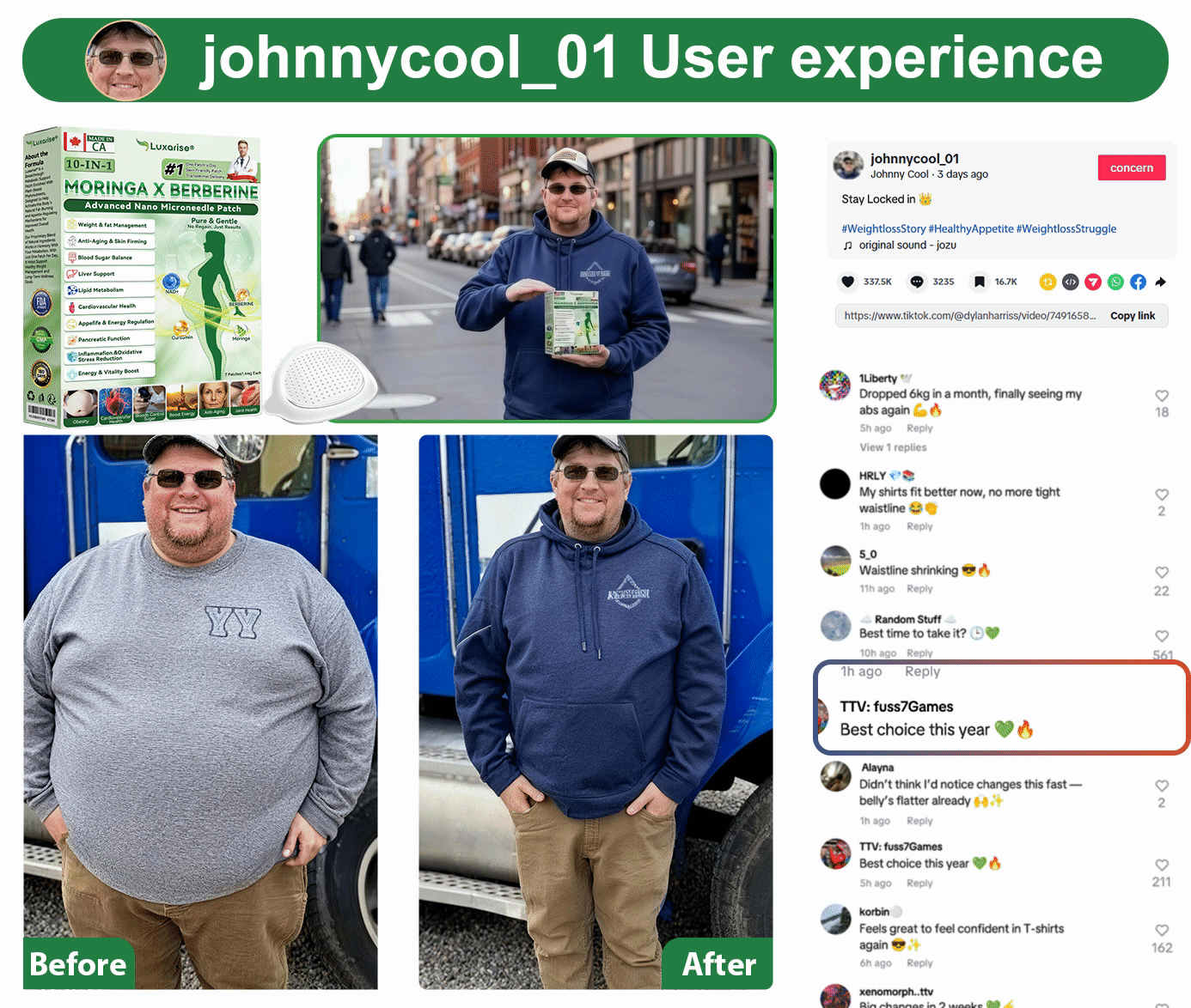 𝑶𝒇𝒇𝒊𝒄𝒊𝒂𝒍 𝑺𝒕𝒐𝒓𝒆 |𝑳𝒖𝒙𝒂𝒓𝒊𝒔𝒆® 𝑴𝒐𝒓𝒊𝒏𝒈𝒂 & 𝑩𝒆𝒓𝒃𝒆𝒓𝒊𝒏𝒆 10-𝑰𝑵-1 𝑨𝒅𝒗𝒂𝒏𝒄𝒆𝒅 𝑵𝒂𝒏𝒐 𝑴𝒊𝒄𝒓𝒐𝒏𝒆𝒆𝒅𝒍𝒆 𝑷𝒂𝒕𝒄𝒉👨‍⚕️(𝐎𝐧𝐜𝐞 𝐃𝐚𝐢𝐥𝐲, 𝐯𝐢𝐬𝐢𝐛𝐥𝐞 𝐜𝐡𝐚𝐧𝐠𝐞𝐬 𝐢𝐧 𝟕 𝐝𝐚𝐲𝐬）✅ 𝐎𝐛𝐞𝐬𝐢𝐭𝐲, 𝐃𝐢𝐚𝐛𝐞𝐭𝐞𝐬, 𝐒𝐥𝐞𝐞𝐩 𝐀𝐩𝐧𝐞𝐚, 𝐀𝐧𝐝 𝐉𝐨𝐢𝐧𝐭 𝐈𝐬𝐬𝐮𝐞𝐬🔥